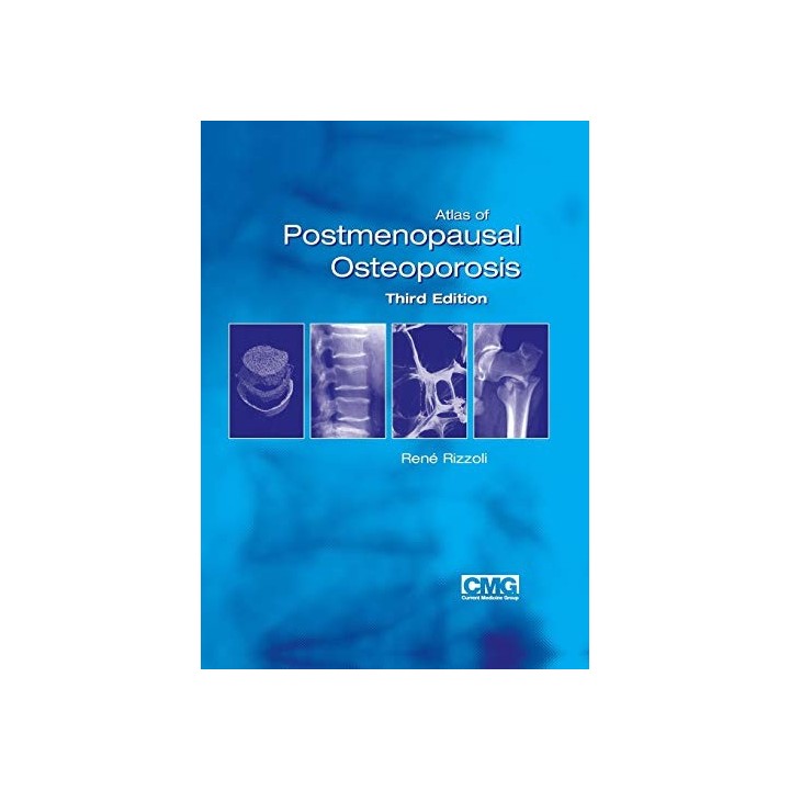 Atlas Of Postmenopausal Osteoporosis (Third Edition)